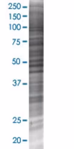 Art5 293t cell transient overexpres sion lysate (denatured) 100 µl