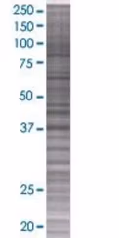 Ppil5 293t cell transient overexpre ssion lysate (denatured) 100 µl