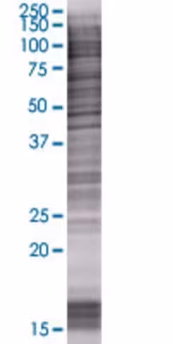 Ovca2 293t cell transient overexpre ssion lysate (denatured) 100 µl