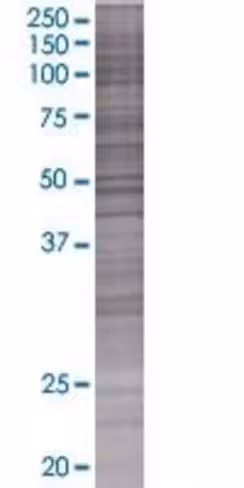 Raet1e 293t cell transient overexpr ession lysate (denatured) 100 µl
