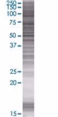 Asz1 293t cell transient overexpres sion lysate (denatured) 100 µl