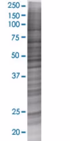 Ptrh1 293t cell transient overexpre ssion lysate (denatured) 100 µl