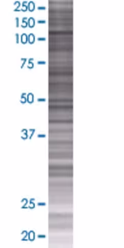 Pasd1 293t cell transient overexpre ssion lysate (denatured) 100 µl