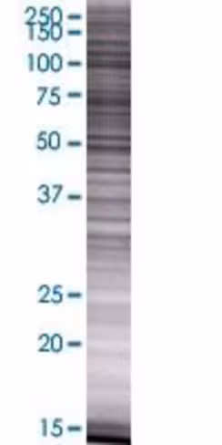 Pnck 293t cell transient overexpres sion lysate (denatured) 100 µl