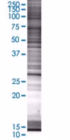 Psma8 293t cell transient overexpre ssion lysate (denatured) 100 µl