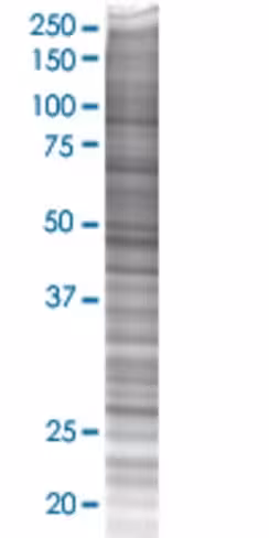 Psma8 293t cell transient overexpre ssion lysate (denatured) 100 µl