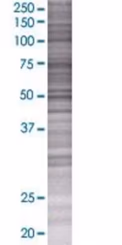 Rad9b 293t cell transient overexpre ssion lysate (denatured) 100 µl