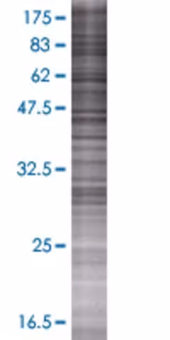 Rdh12 293t cell transient overexpre ssion lysate (denatured) 100 µl