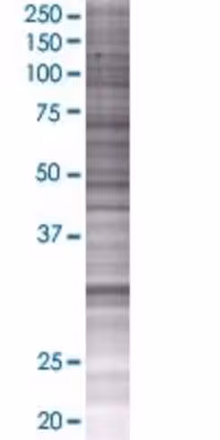 Proca1 293t cell transient overexpr ession lysate (denatured) 100 µl