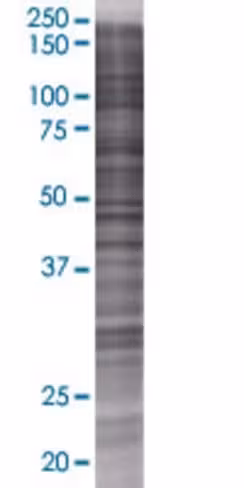 Plb1 293t cell transient overexpres sion lysate (denatured) 100 µl