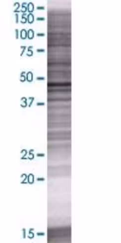Plb1 293t cell transient overexpres sion lysate (denatured) 100 µl
