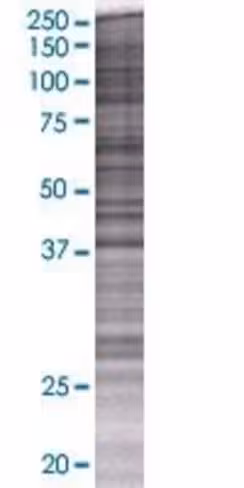 Ppm1k 293t cell transient overexpre ssion lysate (denatured) 100 µl