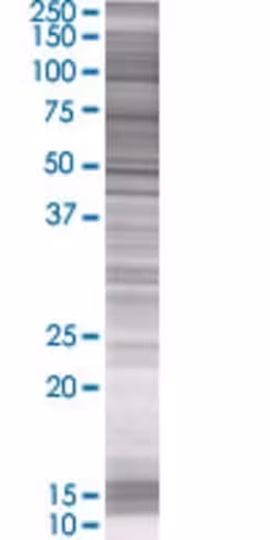 Arsk 293t cell transient overexpres sion lysate (denatured) 100 µl