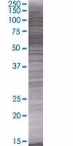 Rbmy1f 293t cell transient overexpr ession lysate (denatured) 100 µl