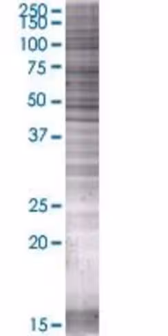 Parp15 293t cell transient overexpr ession lysate (denatured) 100 µl