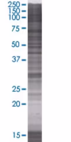 Rdhe2 293t cell transient overexpre ssion lysate (denatured) 100 µl