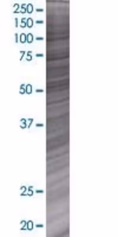 Plekhk1 293t cell transient overexp ression lysate (denatured) 100 µl