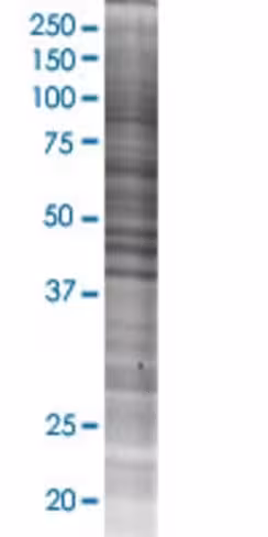 Plekhk1 293t cell transient overexp ression lysate (denatured) 100 µl