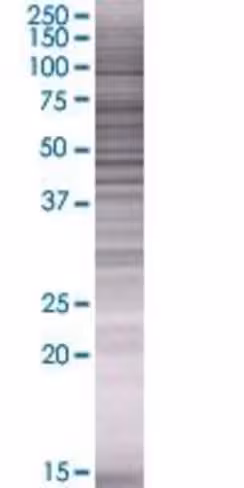 Asphd1 293t cell transient overexpr ession lysate (denatured) 100 µl