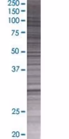 Phyhd1 293t cell transient overexpr ession lysate (denatured) 100 µl