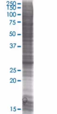 Rassf3 293t cell transient overexpr ession lysate (denatured) 100 µl