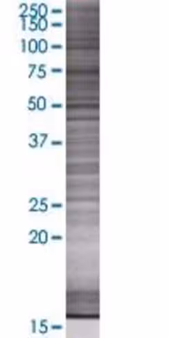 Pla2g4d 293t cell transient overexp ression lysate (denatured) 100 µl