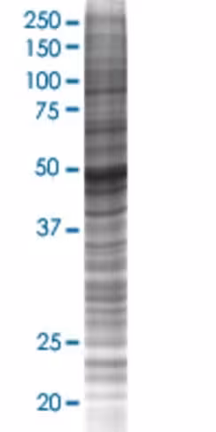 Ptrf 293t cell transient overexpres sion lysate (denatured) 100 µl