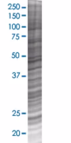 Rab43 293t cell transient overexpre ssion lysate (denatured) 100 µl