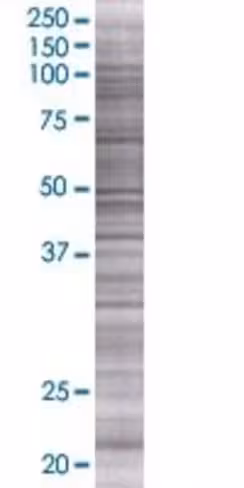 Pabpc1l2a 293t cell transient overe xpression lysate (denatured) 100 µl