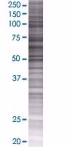 Arsh 293t cell transient overexpres sion lysate (denatured) 100 µl