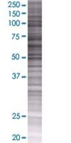 Arsh 293t cell transient overexpres sion lysate (denatured) 100 µl