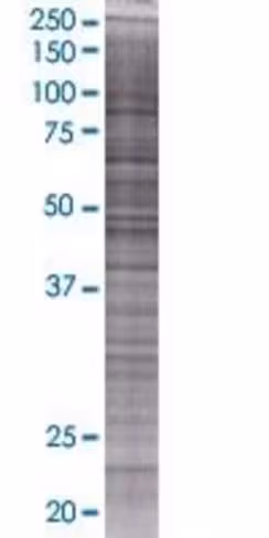 Rbpms2 293t cell transient overexpr ession lysate (denatured) 100 µl