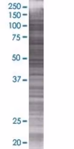Raet1g 293t cell transient overexpr ession lysate (denatured) 100 µl