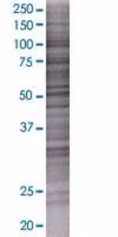 Rbm12b 293t cell transient overexpr ession lysate (denatured) 100 µl