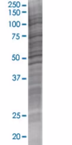 Pabpcp2 293t cell transient overexp ression lysate (denatured) 100 µl