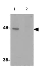 Kit de Dosage Calcium (Colorimétrique) 250 Tests