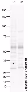 Kit de Dosage Acides Gras libres - Quantification 100 Tests