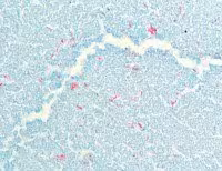 BSS AFB Staining Kit ref 08432503001 tranche 1