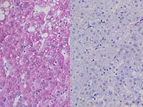 Diastase Kit ref 05279208001 tranche 2