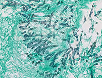 GMS II Staining Kit ref 05412749001 tranche 1