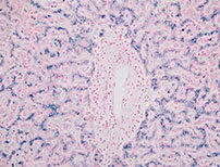 Iron Staining Kit ref 05279259001 tranche 2