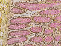 Mucicarmine Staining Kit ref 05279275001 tranche 5