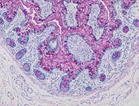 PAS Staining Kit ref 05279291001 tranche 1