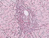 Reticulum II Staining Kit ref 05279399001 tranche 5