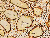 Steiner II Staining Kit ref 06521894001 tranche 5