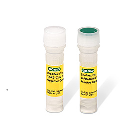 BPX Human IgG SARS-Cov-2 Controls