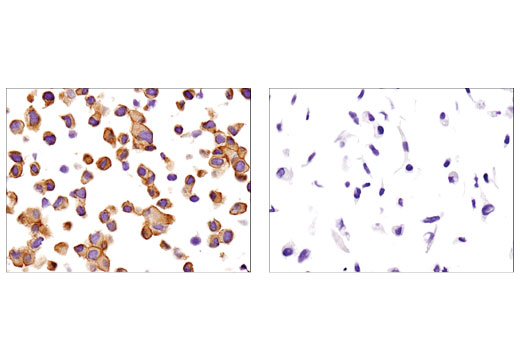 SignalSlide LKB1 IHC Controls 1 pack