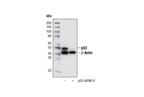 SignalSilence p53 siRNA II 300 µl