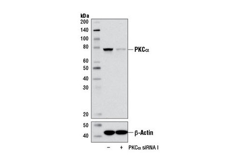 SignalSilence PKCalpha siRNA I 300 µl