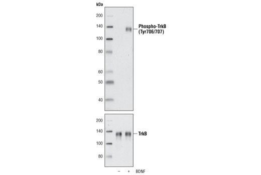 Human Brain-Derived Neurotrophic Factor (BDNF) 10 µg